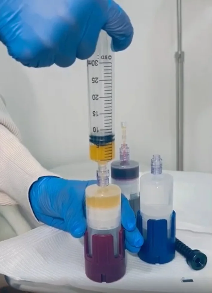 KeyPRP dual-spin centrifuge by MD Biologix at Pureté Medical Spa in Toronto