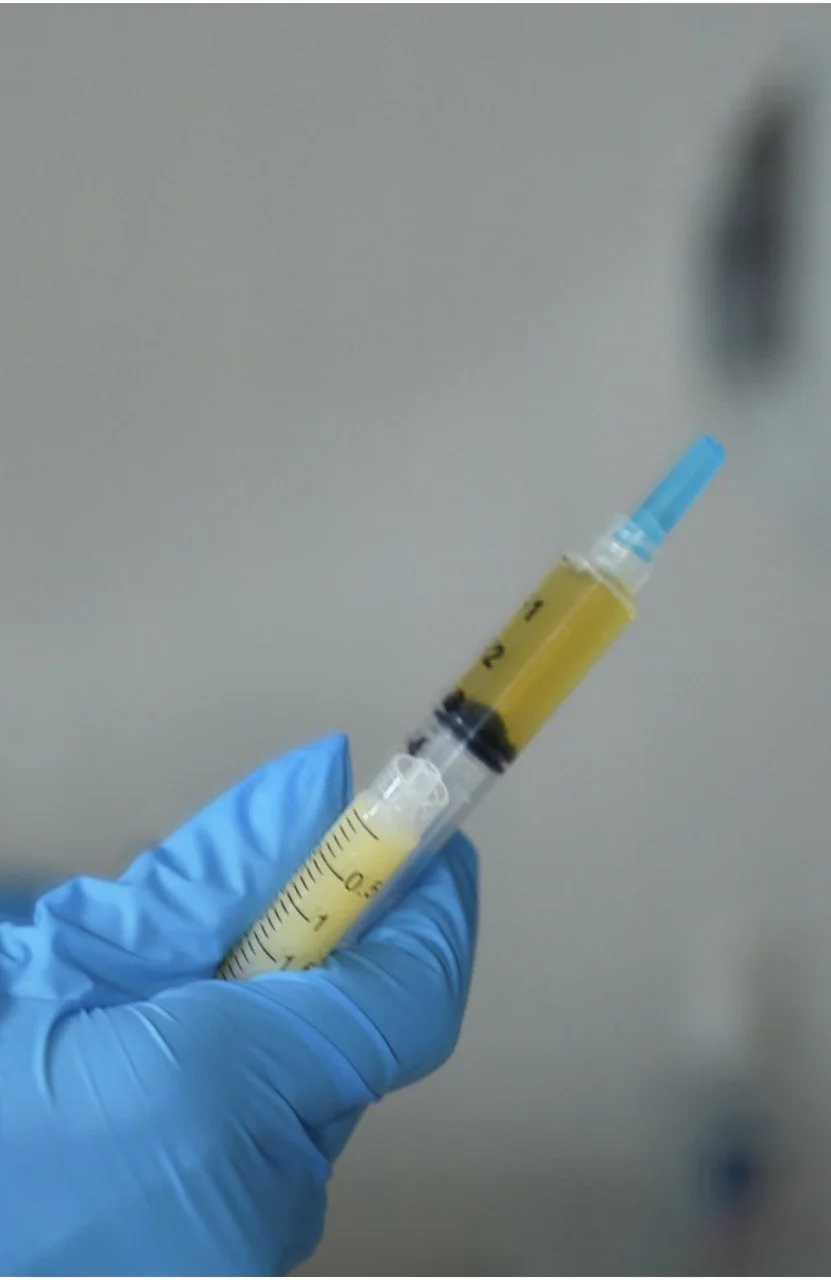 PRP BioFiller golden plasma syringe at Pureté Medical Spa
