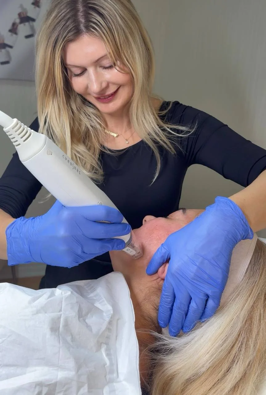 Vampire Facial dual-spin PRP microneedling treatment at Pureté Medical Spa